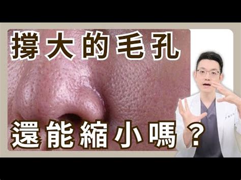 右臉上長白毛|臉長白毛位置暗示何事？